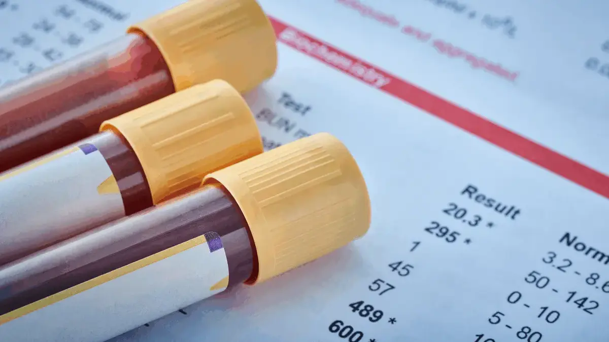 Ilustrasi golongan darah.(canva.com)