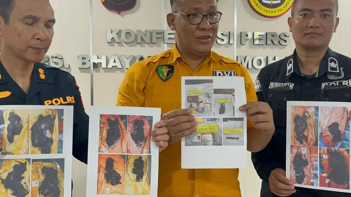 Kepala RS Bhayangkara Moh Hasan Palembang Kombes Pol Budi Susanto di Palembang, Jumat (8/5/2026). (ANTARA/Ahma